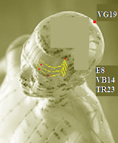 Применяемые в практике ОС биологически активные точки ян-бай, тоу-гуан-мин,
сы-чжу-кун и тоу-вэй (симметричные, расположены на голове). Подробности - смотреть в любом атласе по акупунктуре